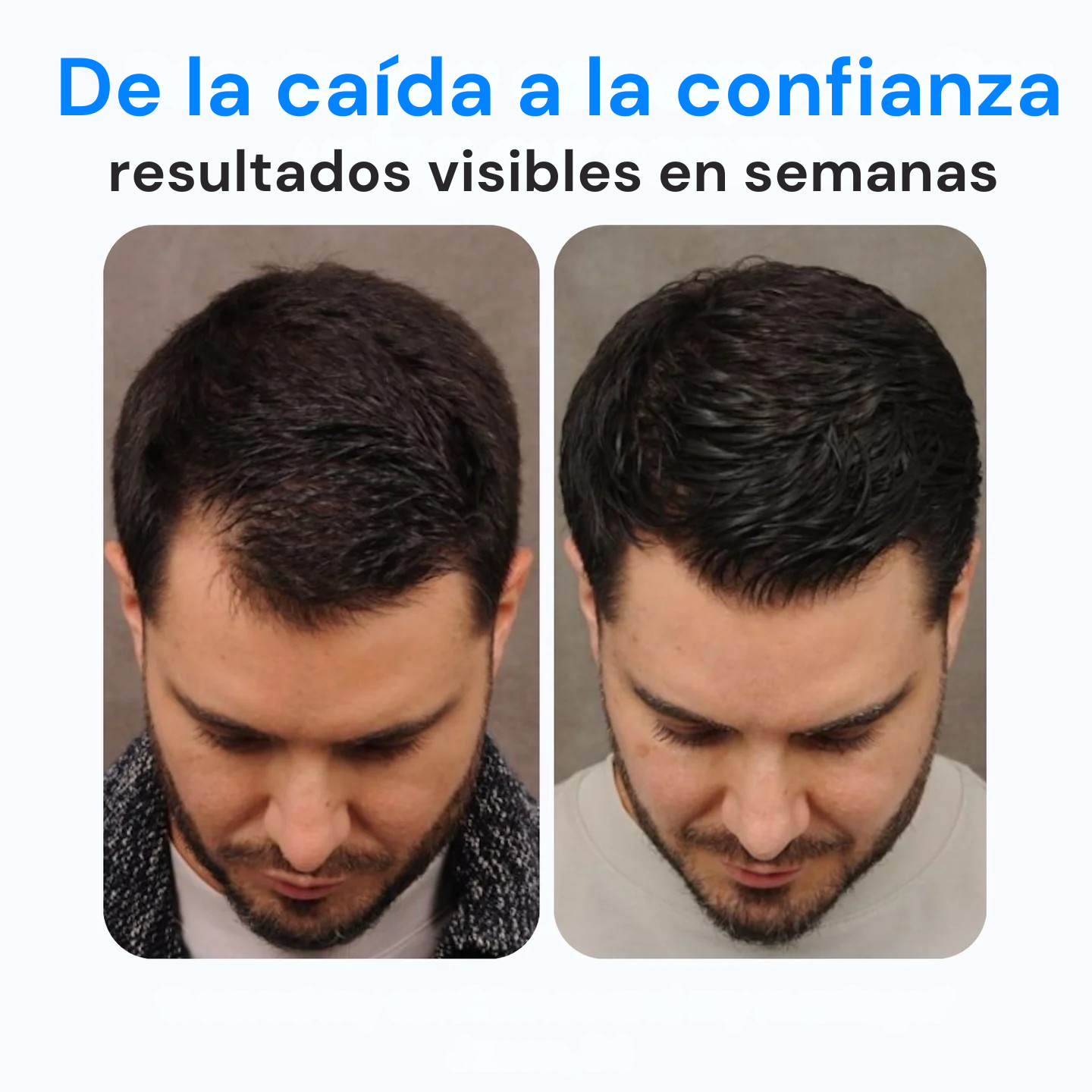 Roll-On Capilar para Frenar la Caída