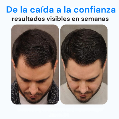 Roll-On Capilar para Frenar la Caída