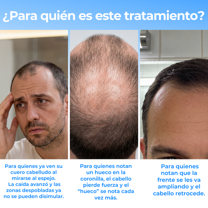 Roll-On Capilar para Frenar la Caída